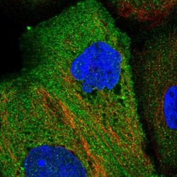 EHM2 Antibody, Novus Biologicals:Antibodies:Primary Antibodies